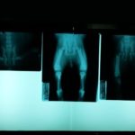 radiograph-1749188__340